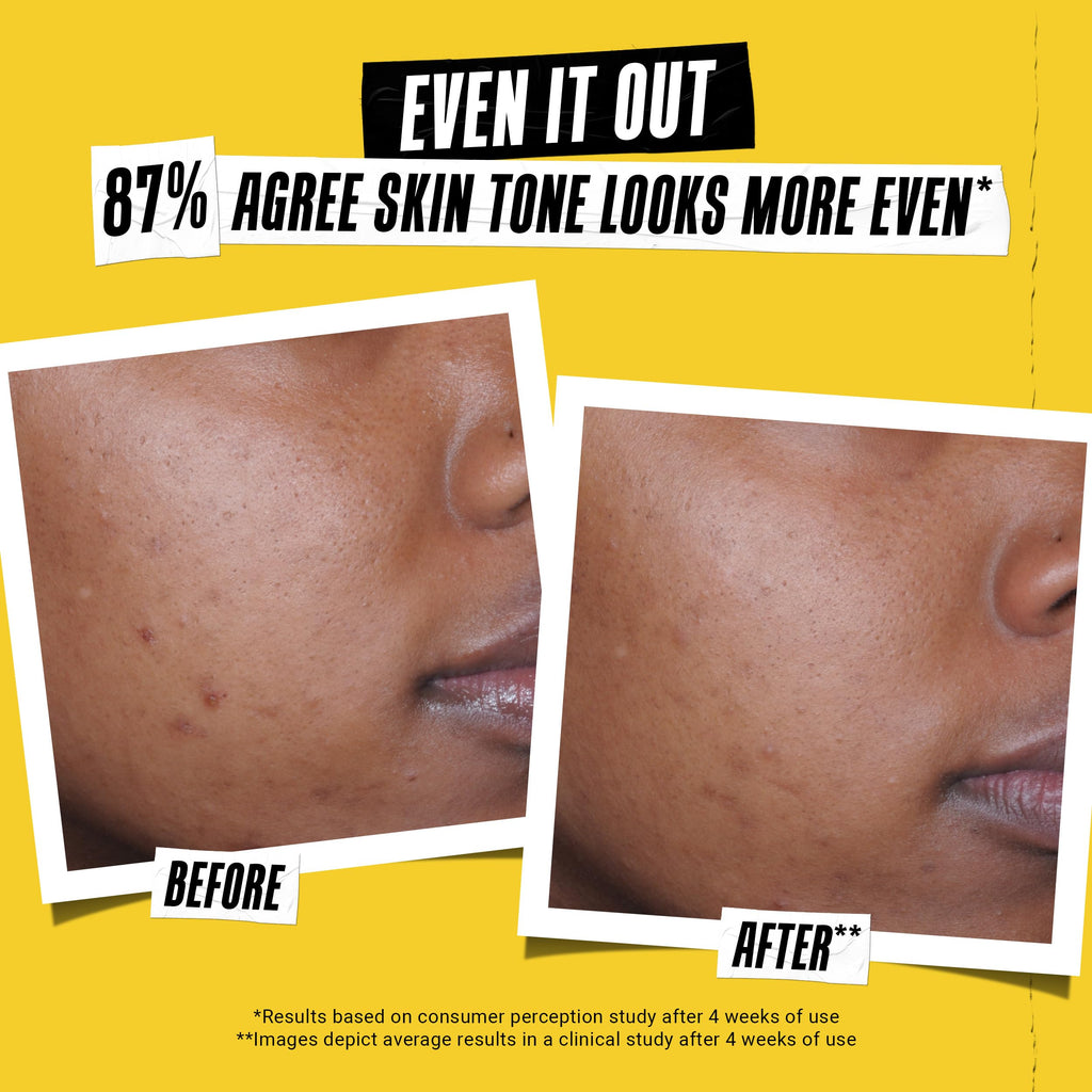 Kiehl's - Better Screen UV Serum SPF 50+ Facial Sunscreen, Collagen Peptide | Facial Sunscreen for Shielding UVA & UVB - With Collagen Peptide - Corrects Visible Signs of Aging