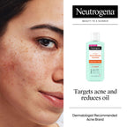 Neutrogena Acne Stress Control Face Toner, 2% Salicylic Acid, 8 fl. oz | Oil-Free Triple-Action, Green Tea & Cucumber Extract, Nourishing & Refreshing