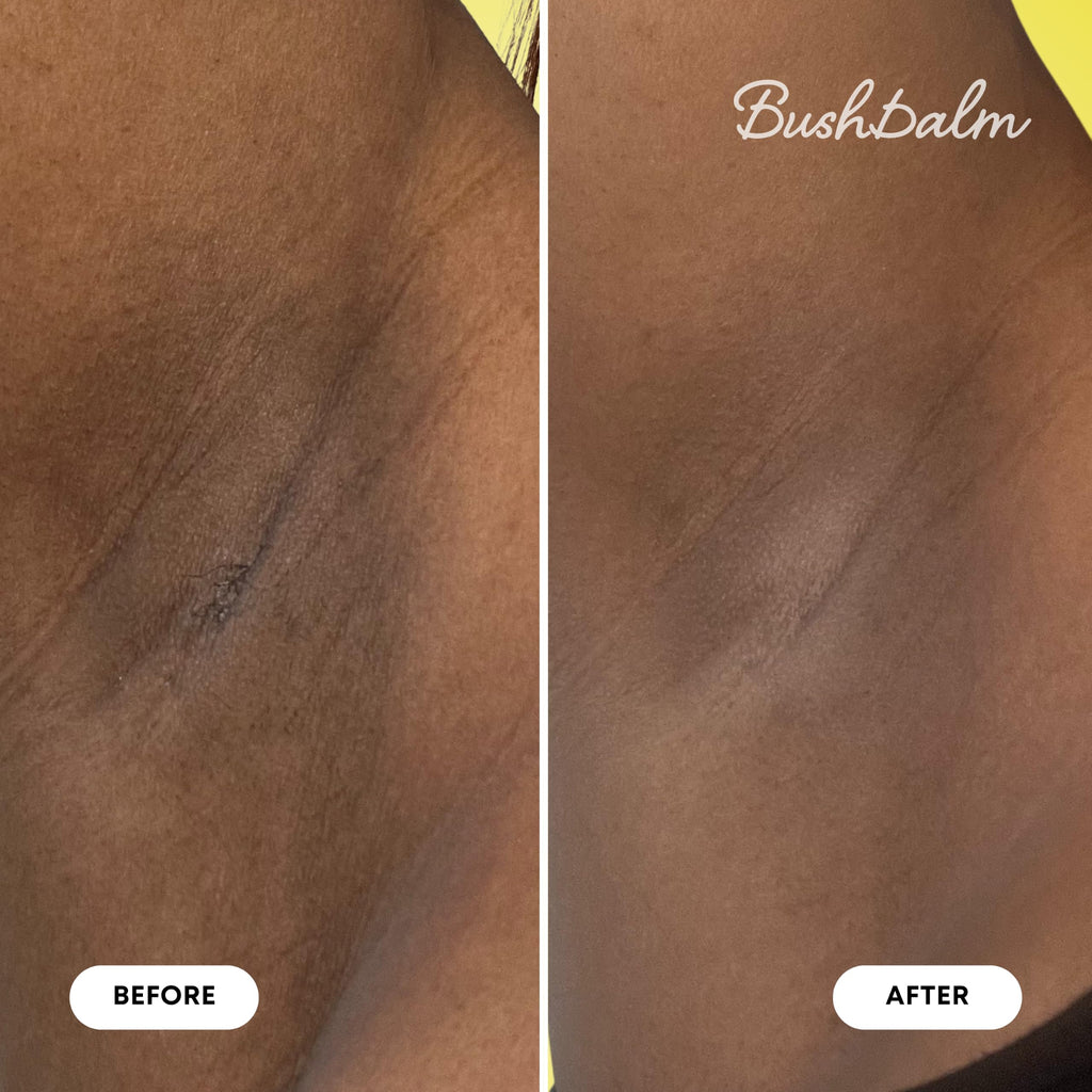 Bushbalm Dark Spot Exfoliating Body Scrub - Bermuda, 236ml | Brightening & Exfoliating Sugar Scrub for Dark Spots & Uneven Skin Tone. Formulated with Naturally-Derived Ingredients