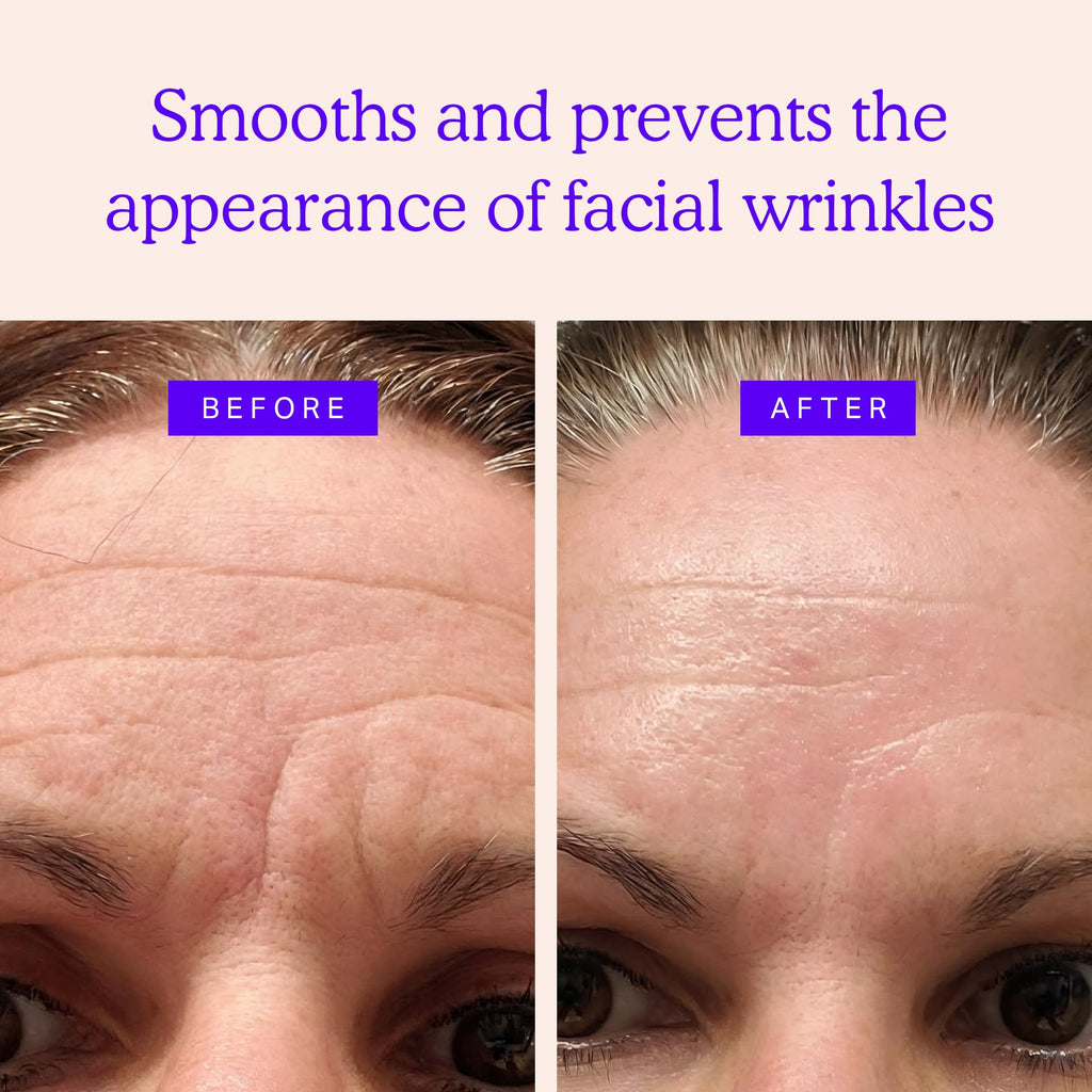 BLUMBODY Face, Forehead Wrinkle Patches – Mini Anti-Wrinkle Facial Patches for Eyes, Mouth, Forehead – Triangle Non-Silicone Face Tape for Elevens, Crows Feet and Fine Lines – 160 Facial Patches