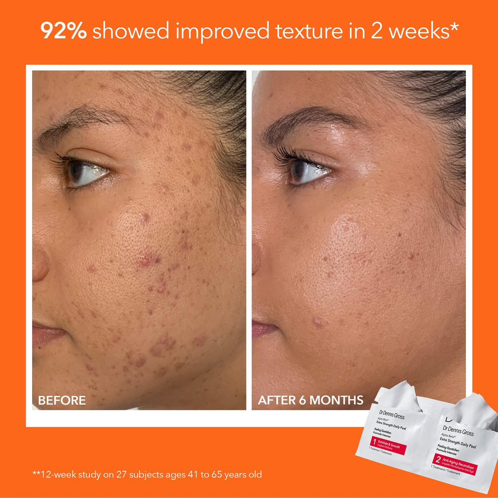 Dr Dennis Gross Extra Strength Radiant, Smooth & Firm Skincare Kit | Dermatologist Developed - Full-Size Alpha Beta Peel, Travel-Size Vitamin C Lactic Dewy Deep Cream & Creamy Cleanser
