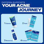 Differin Acne Spot Treatment, Max Strength, 10% Benzoyl Peroxide, 1 fl oz | Fast-Acting Pimple Treatment, Maximum Strength OTC Formula, Clears Acne Overnight, For Face, Dermatologist Brand