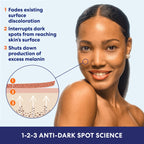 Palmer's Skin Success Body Lotion, Anti-Dark Spot Fade Milk (8.5 Oz) | Moisturizer with Niacinamide, Fades Age Spots, Helps Uneven Skin Tone & Hyperpigmentation, Dermatologist Approved
