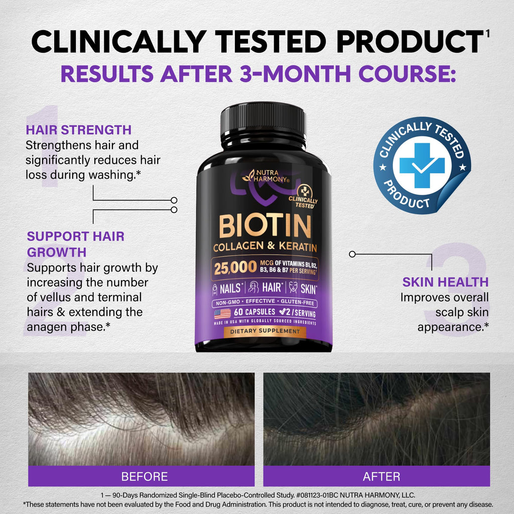 Biotin, Collagen, Hyaluronic Acid & Keratin - Hair Growth Support - 60 Caps | Hair, Skin & Nails Vitamins - Clinically Tested Supplement for Men & Women - 25000mcg Vitamins B1, B2, B3, B6 & B7