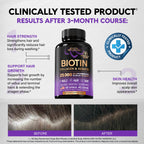 Biotin, Collagen, Hyaluronic Acid & Keratin - Hair Growth Support - 60 Caps | Hair, Skin & Nails Vitamins - Clinically Tested Supplement for Men & Women - 25000mcg Vitamins B1, B2, B3, B6 & B7