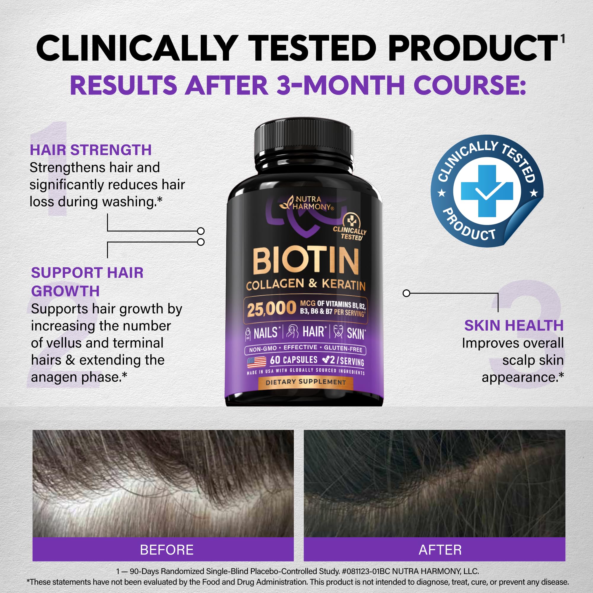 Biotin, Collagen, Hyaluronic Acid & Keratin - Hair Growth Support - 60 Caps | Hair, Skin & Nails Vitamins - Clinically Tested Supplement for Men & Women - 25000mcg Vitamins B1, B2, B3, B6 & B7