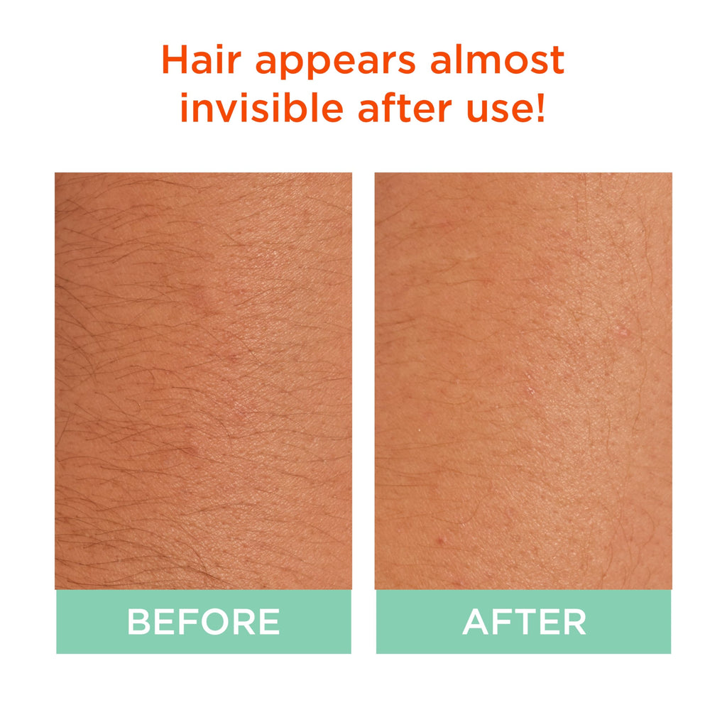 Sally Hansen Bleach Cream for Facial & Body Hair | Vegan Formula with Glycerin | All Skin Types