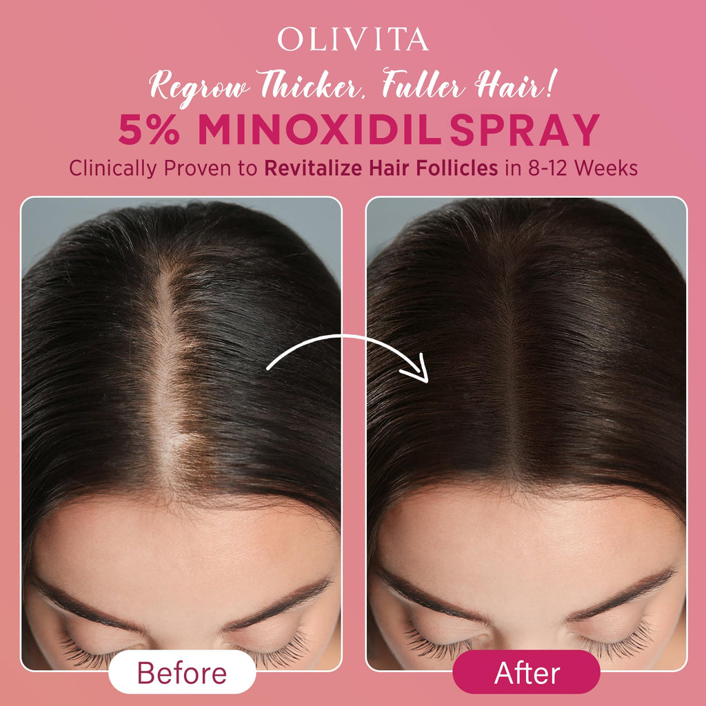 5% Minoxidil Spray for Women Hair Growth: Extra Strength Hair Regrowth Treatment – Revitalize Hair Follicles & Regrow Thicker, Fuller Hair – Hair Loss Solution - 2 Packs