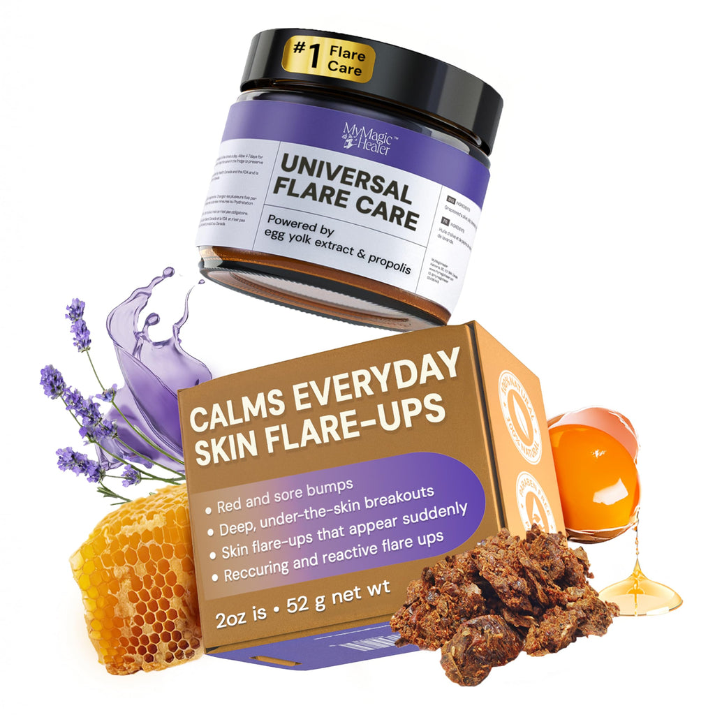 MyMagicHealer Universal Flare Care – Solution for Everyday Skin Flare-Ups | Drawing Salve for Boils & Cysts, Hidradenitis Suppurativa, Folliculitis | Irritated Skin and Chafing Relief 1 oz