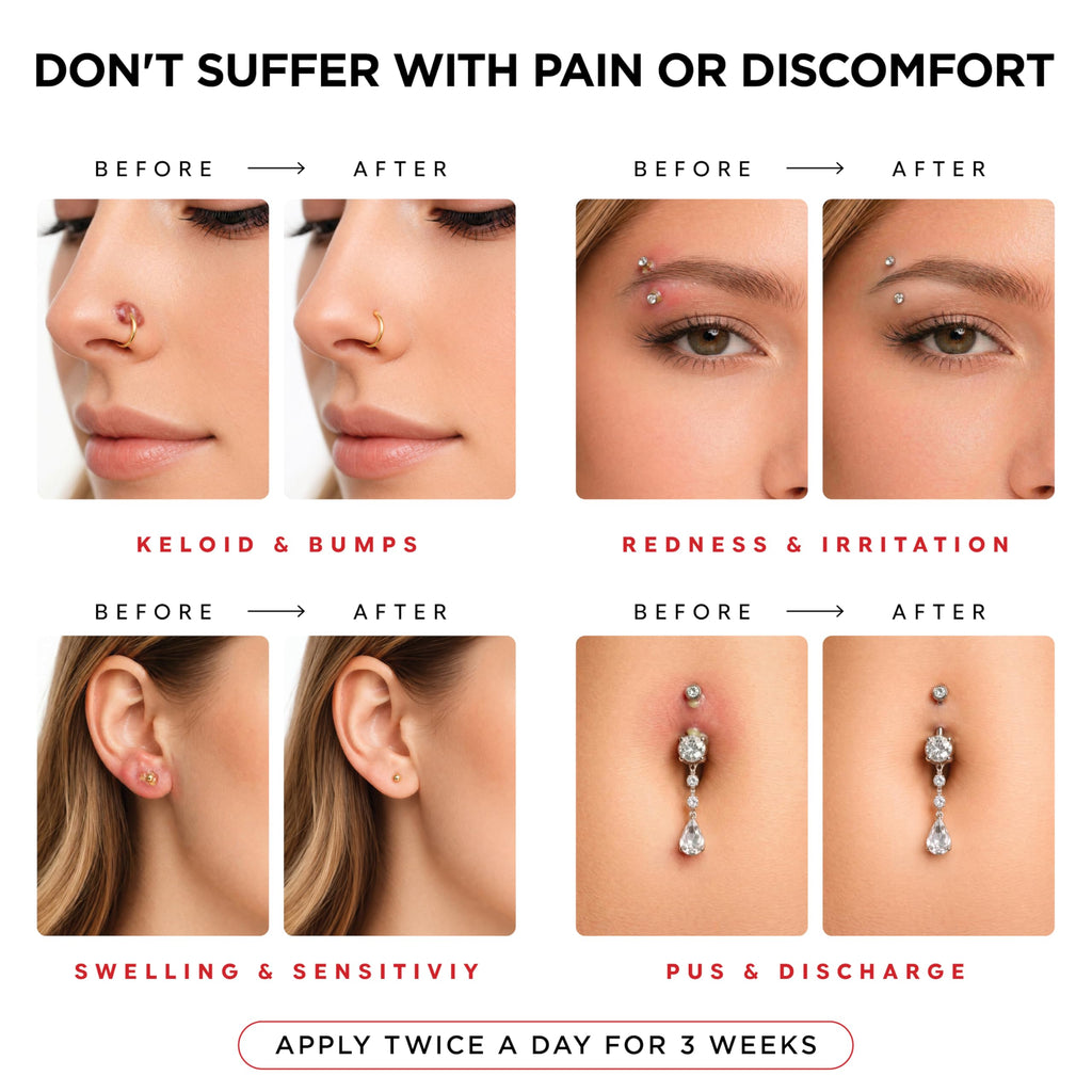 Piercing Aftercare Spray | Ear Piercing Cleaner | Sterile Saline Spray 8oz | Saline Solution for Piercings; Aftercare of Pierced Ear, Septum, Belly, Nose, Body; Pierce Cleaner Salt Mist Bump Solution