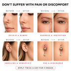 Piercing Aftercare Spray | Ear Piercing Cleaner | Sterile Saline Spray 8oz | Saline Solution for Piercings; Aftercare of Pierced Ear, Septum, Belly, Nose, Body; Pierce Cleaner Salt Mist Bump Solution