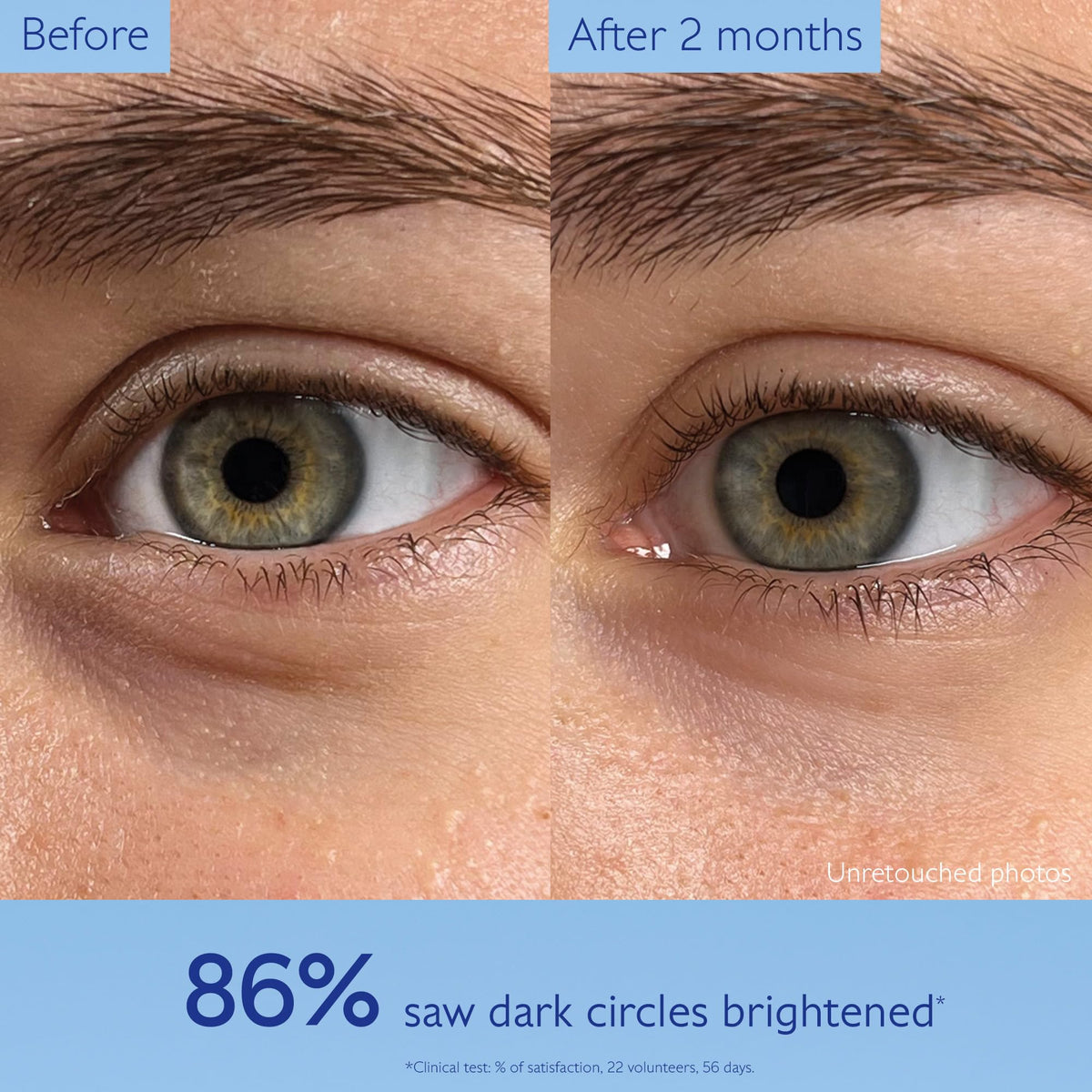 Caudalie Vinoperfect Dark Circle Brightening Caffeine Eye Cream - 15 mL