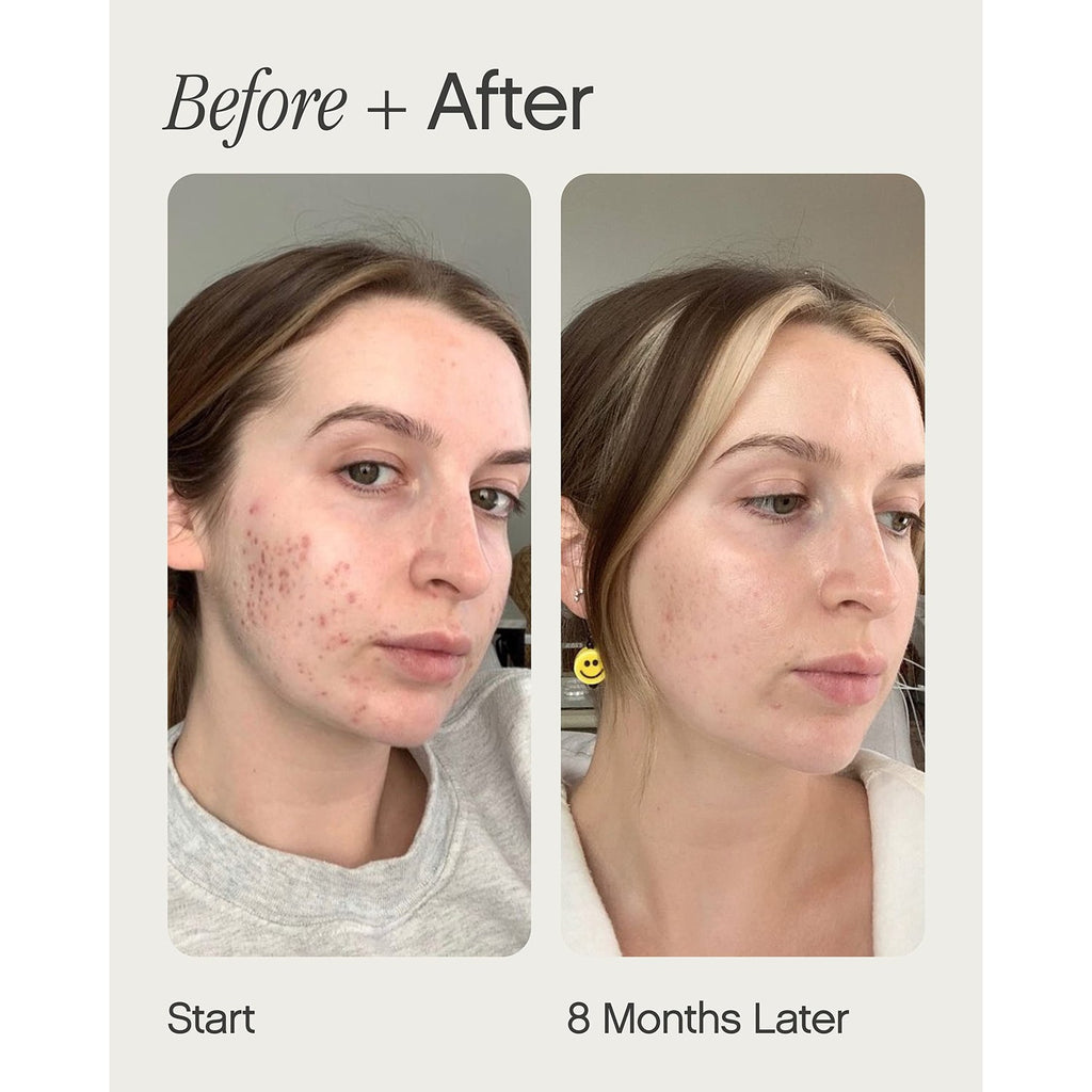 Topicals, Faded Brightening Serum, Reduces Discoloration, 0.5 Fl Oz | Clears Post-Blemish Marks, Scars & Spots, Kojic Acid & Niacinamide, Dermatologist-Tested, Vegan