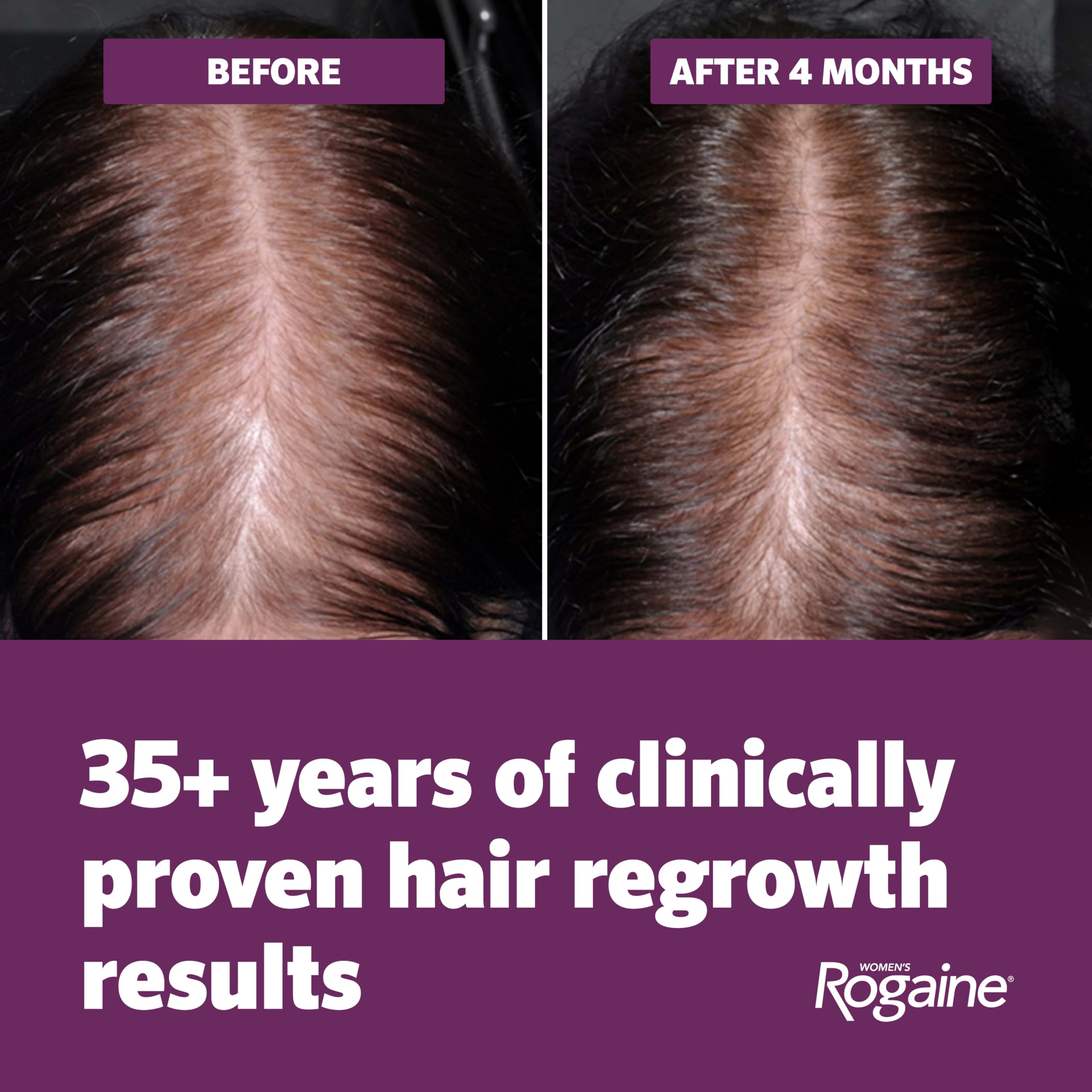 Women's Rogaine Hair Growth Foam, 5% Topical Minoxidil, 4 Mo, 2x 2.11 Oz
