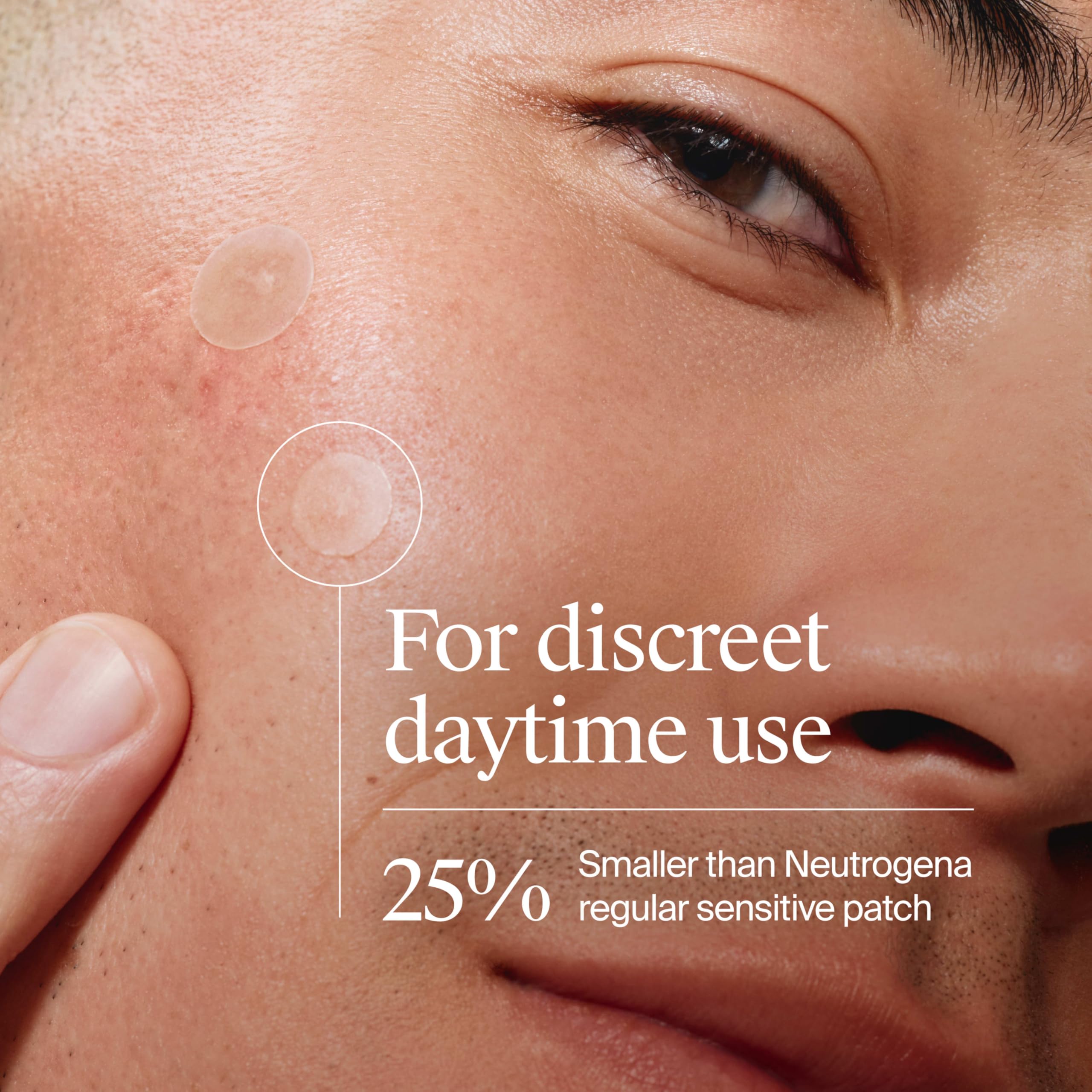 Buy now Neutrogena Mini Acne Patches for Sensitive Skin, Small Hydrocolloid Acne Spot Treatment Reduces the Look of Blemishes in 6-8 Hours, Gentle Non-Medicated Blemish Patches, 36 ct at indiglob india