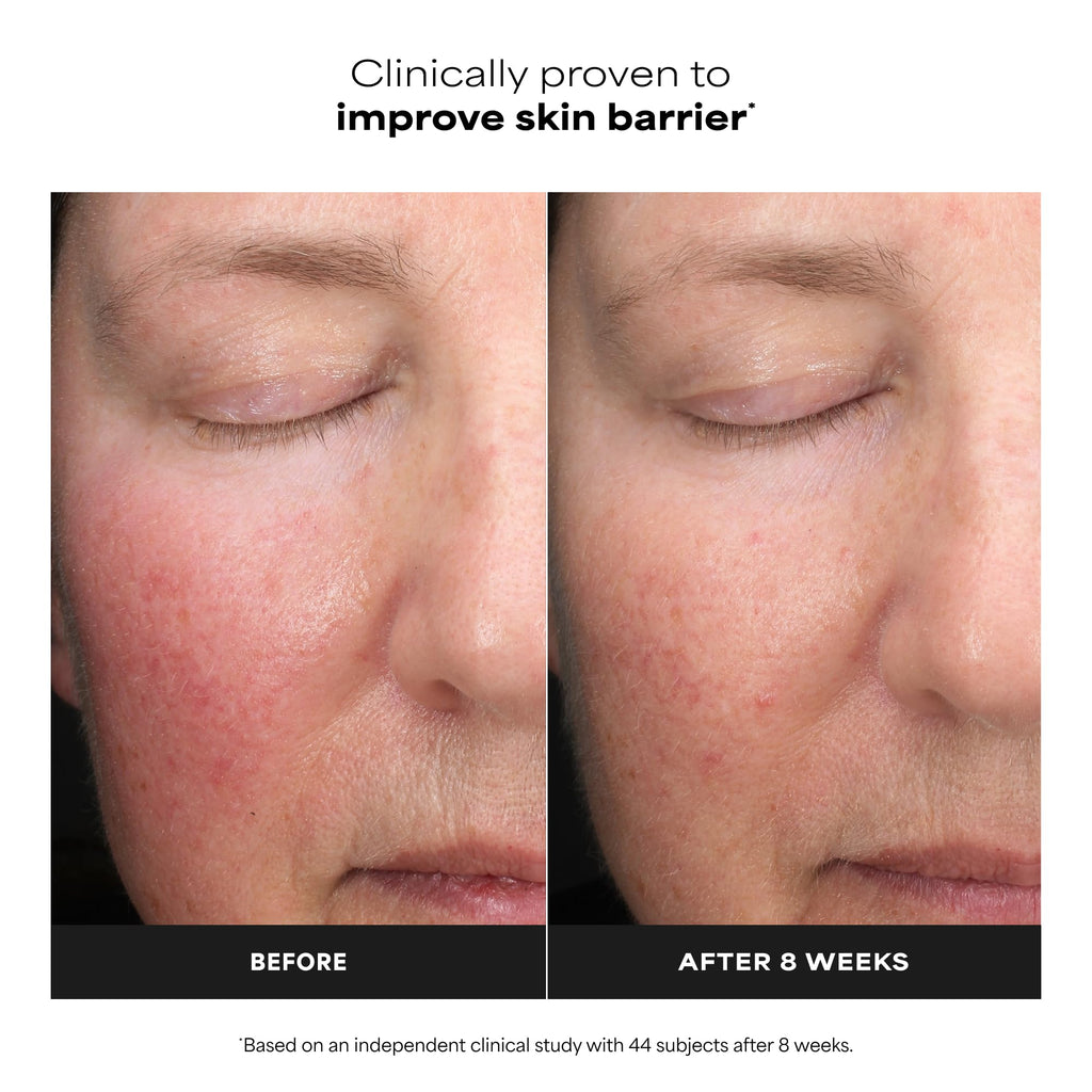 Paula's Choice 6% Mandelic + 2% Lactic Acid Liquid Exfoliant | Gentle AHA Exfoliation for Discoloration, Bumpy Texture & Radiance, for Sensitive Skin, Fragrance-Free