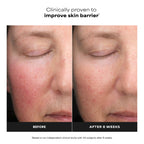 Paula's Choice 6% Mandelic + 2% Lactic Acid Liquid Exfoliant | Gentle AHA Exfoliation for Discoloration, Bumpy Texture & Radiance, for Sensitive Skin, Fragrance-Free