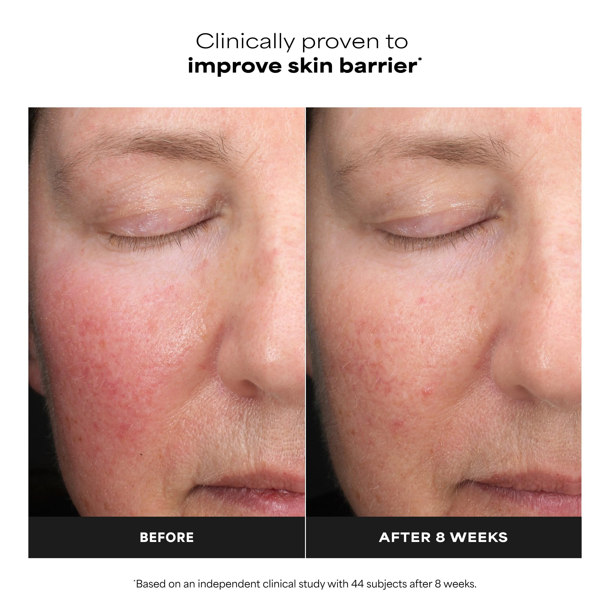 Paula's Choice 6% Mandelic + 2% Lactic Acid Liquid Exfoliant | Gentle AHA Exfoliation for Discoloration, Bumpy Texture & Radiance, for Sensitive Skin, Fragrance-Free