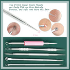 Blackhead Remover Tools 16 PCS Pimple Extractor with Metal Box