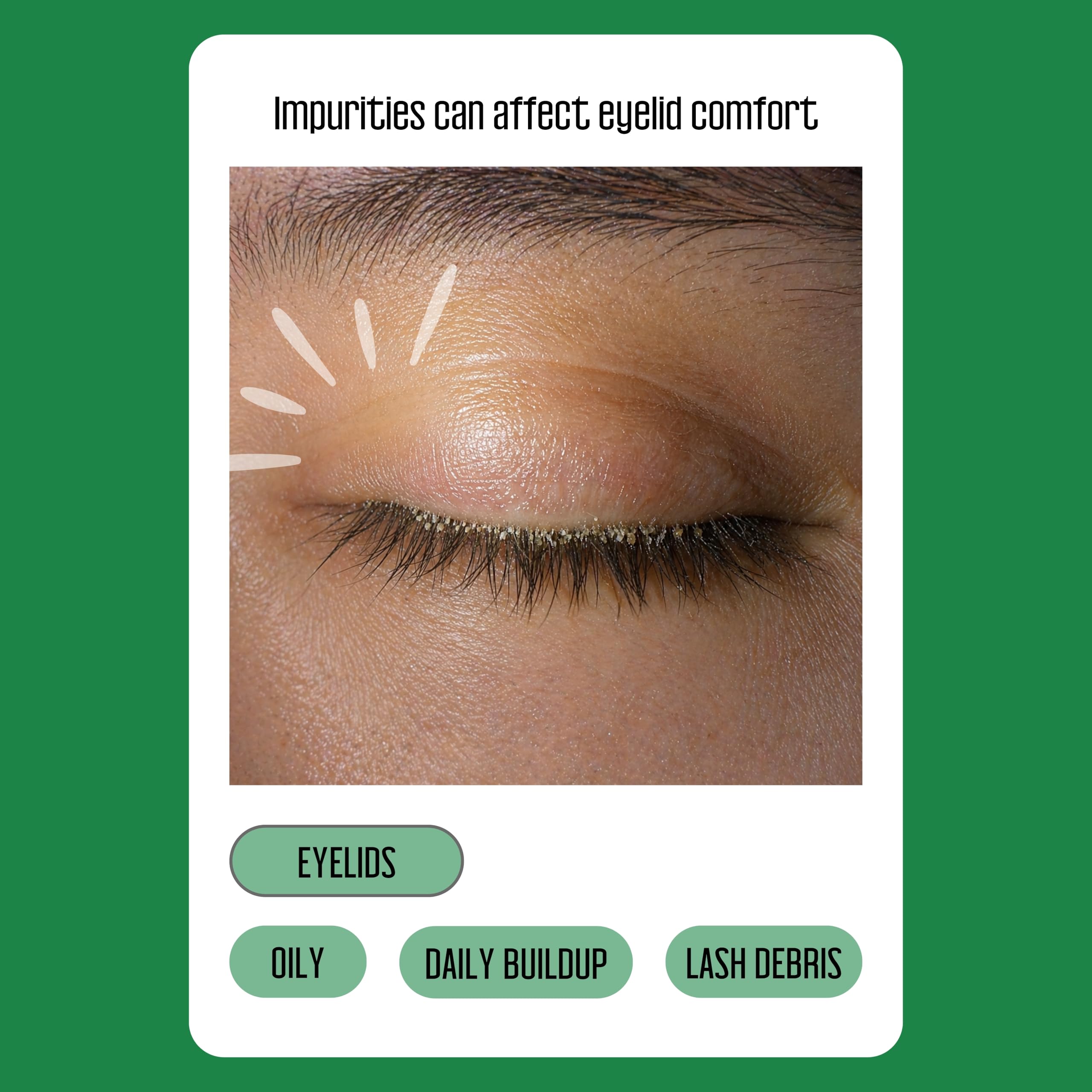 100PCs Tea Tree Eyelid Wipes – Cleaning Eye Wipes for People with Dry Eyes & Allergies – Gentle Eyelid Cleanser with Hyaluronic Acid, Chamomile and Aloe – Individually Wrapped & Biodegradable
