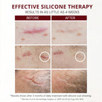 HealFast Silicone Scar Gel - Medical Grade Scar Cream for Surgical Scars