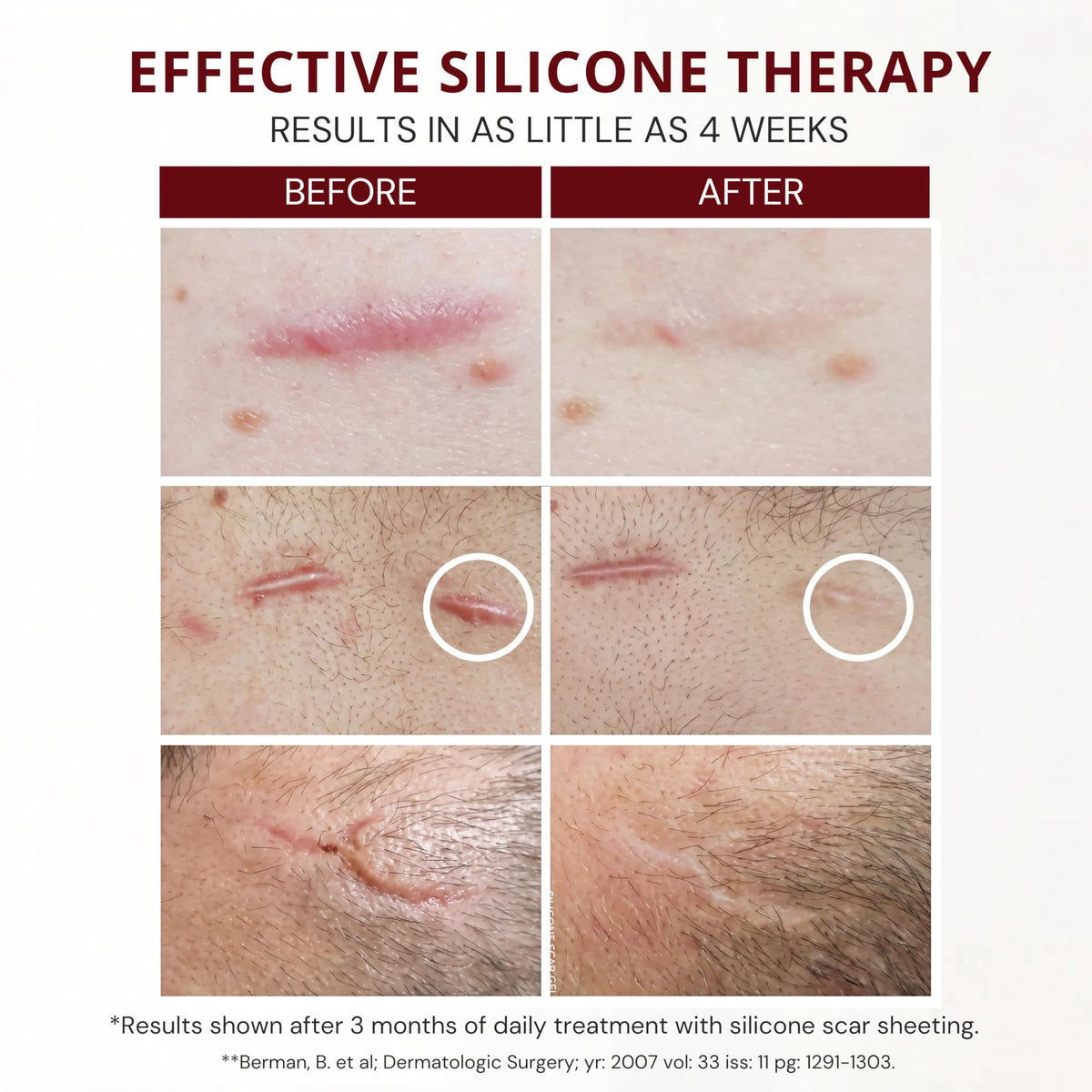 HealFast Silicone Scar Gel - Medical Grade Scar Cream for Surgical Scars