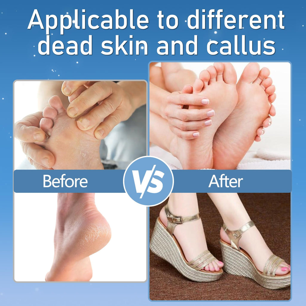 Callus Remover for Feet, Electric Foot Callus Remover Waterproof with 3 Rollers 2 Speed Battery Display,17 in1 Rechargeable Foot File Pedicure Kits for Dead Hard Cracked Dry Skin（White
