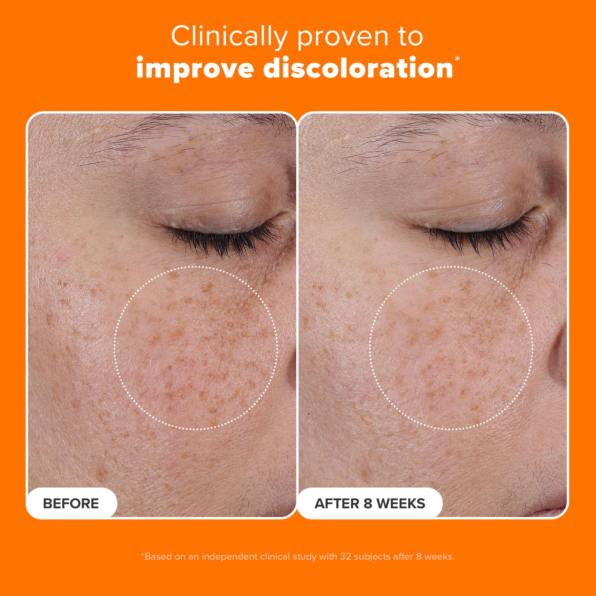 Buy now PaulaÆ’??s Choice 25% Vitamin C Serum with Glutathione & Antioxidants, Face Serum Improves Discoloration, Uneven Tone & Firms, All Skin Types, Fragrance-Free, 1oz at indiglob india