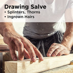 PRID Drawing Salve by Hyland's Naturals (2 PACK)