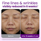 Reduces Fine Lines and Wrinkles in 6 weeks or Less, CLEAN SKIN CLUB Healthy Aging Clean Towels® XL, Disposable Face Towels, XL - 1 Pack (50 count)