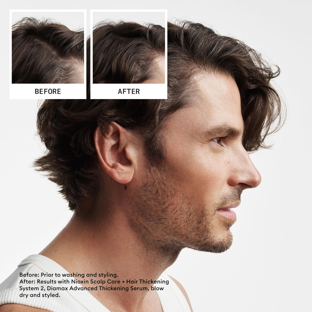 NIOXIN System 2 | Scalp Care | Shampoo | Hair Thickening | For Natural Hair | Scalp Health | For Natural Hair with Progressed Thinning | Cleanse & Boost Hair Density with Niacinamide & Biotin