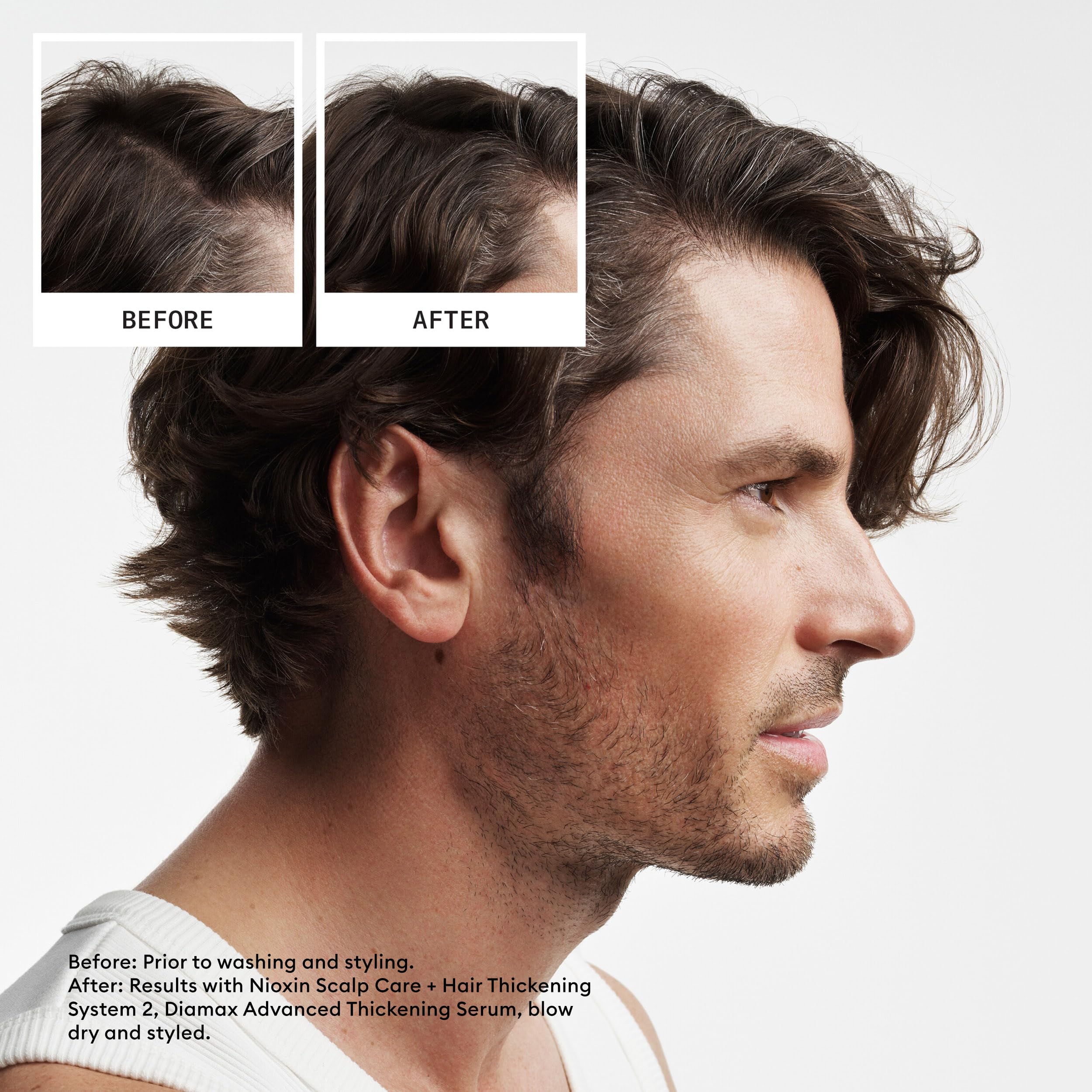 NIOXIN System 2 | Scalp Care | Shampoo | Hair Thickening | For Natural Hair | Scalp Health | For Natural Hair with Progressed Thinning | Cleanse & Boost Hair Density with Niacinamide & Biotin
