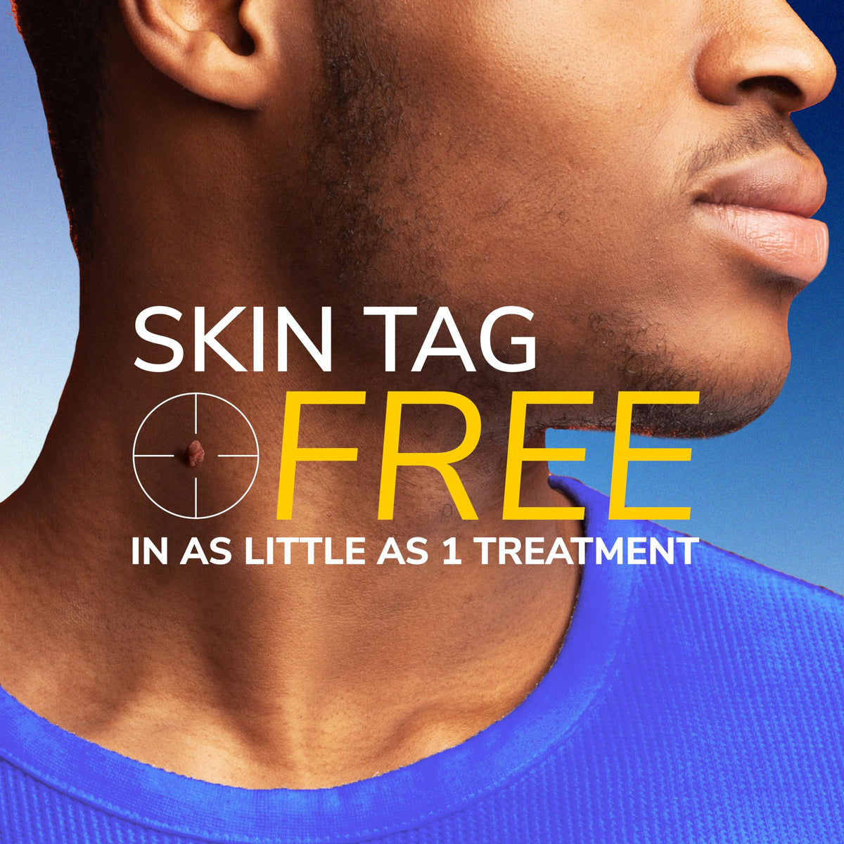 Dr. Scholl's Freeze Away Skin Tag Remover, Skin Tag Removal Kit, 8 Count