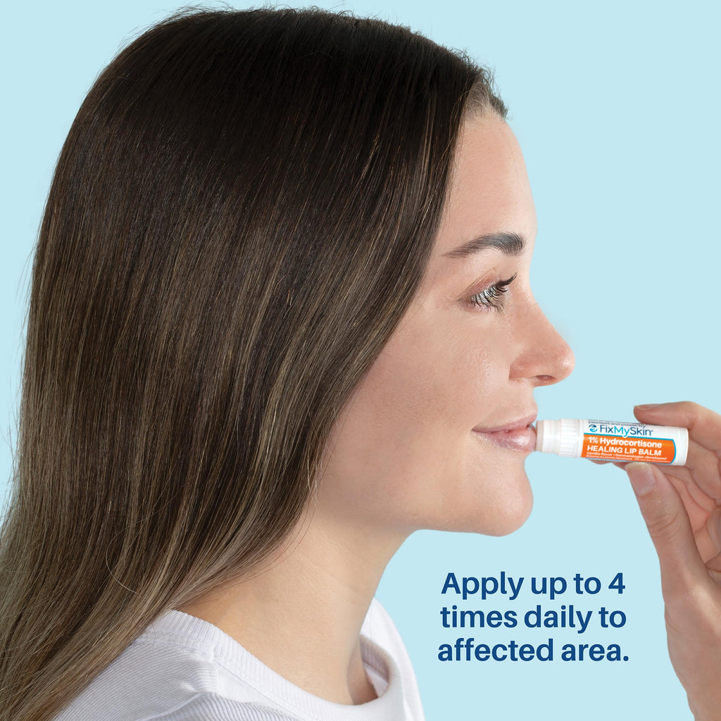 FixMySkin 1% Hydrocortisone Healing Lip Balm, Vanilla, 0.15 oz