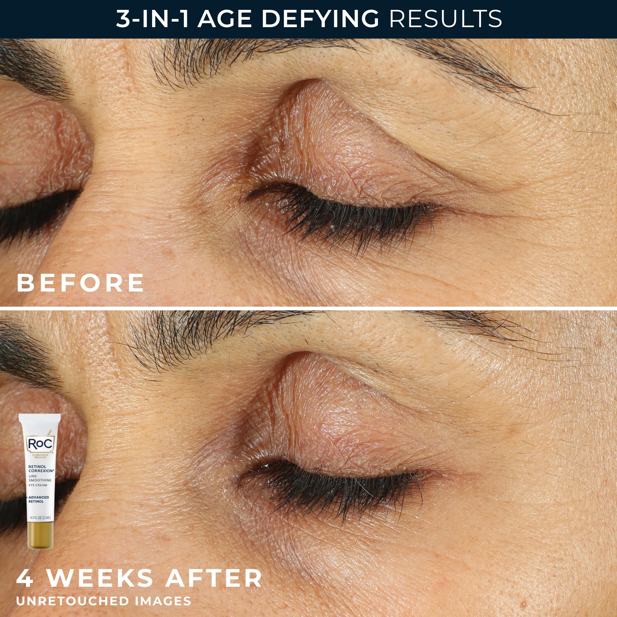 Buy now RoC Retinol Correxion Value Set Duo, Deep Wrinkle Anti-Aging Night Face Cream + Under Eye Cream for Dark Circles & Puffiness - Retinol Eye Care at indiglob india