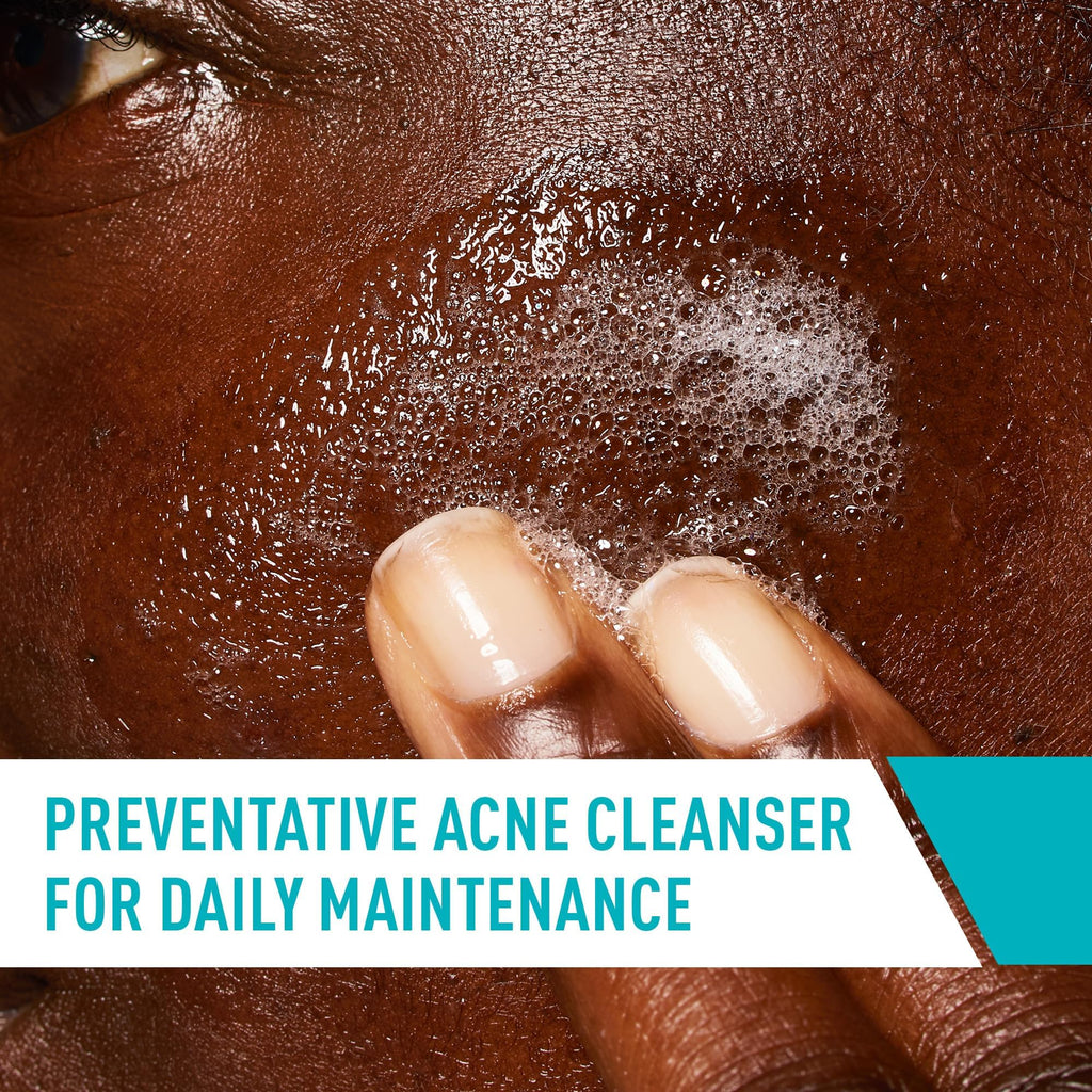 CeraVe Acne Control Cleanser, Face Wash with 2% Salicylic Acid, 8 oz | Skin Care with Niacinamide, Acne Face Wash, Acne Treatment For Face, Ceramides, Fragrance Free, Gentle, Oil Absorbing Clay