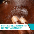 CeraVe Acne Control Cleanser, Face Wash with 2% Salicylic Acid, 8 oz | Skin Care with Niacinamide, Acne Face Wash, Acne Treatment For Face, Ceramides, Fragrance Free, Gentle, Oil Absorbing Clay