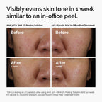 The Ordinary AHA 30% + BHA 2% Peeling Solution, Advanced Exfoliating Peel for Brighter Skin