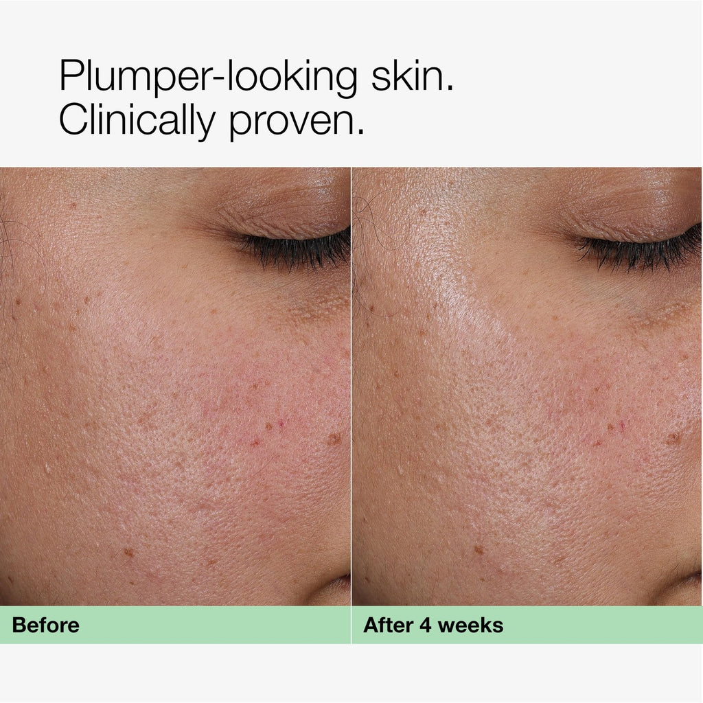 Clinique Smart Clinical Repair Collagen + PDRN Cream Moisturizer for Firmer Skin with Peptides and Hyaluronic Acid | Anti Aging Face Cream, 1.7 Fl Oz