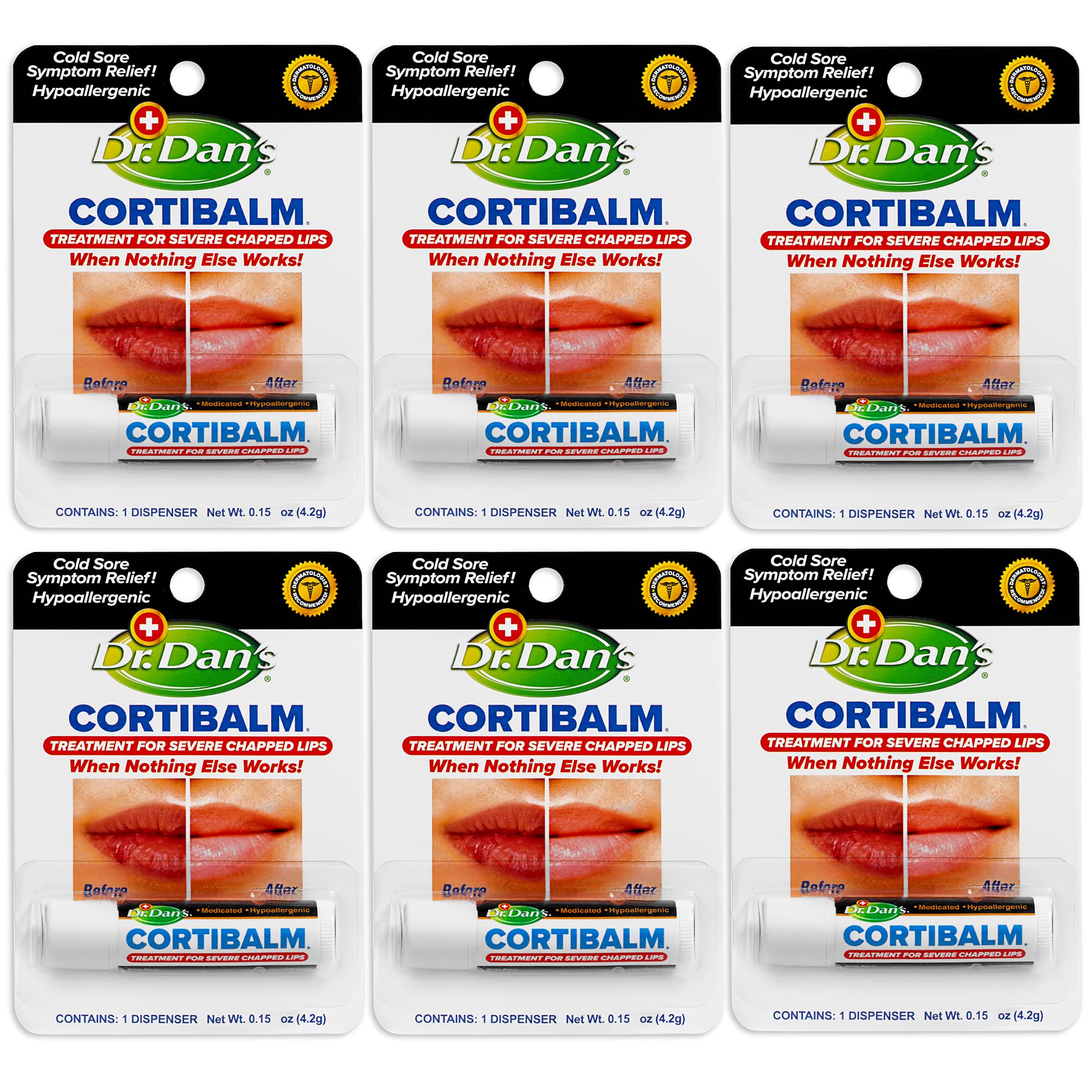 Buy now Dr. Dan's Cortibalm-5 pack- for Dry Cracked Lips Healing Lip Balm for Severely Chapped Lips - Designed for Men, Women and Children at indiglob india