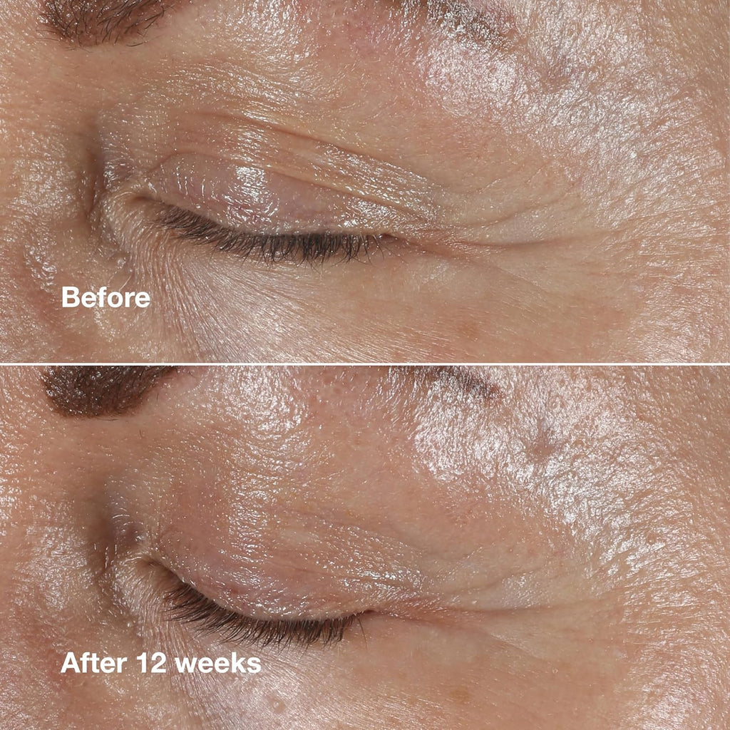 Buy now Clinique Smart Clinical Repair Wrinkle Correcting Eye Cream With Hyaluronic Acid + Peptides | Anti-Aging, Hydrating + Depuffing at indiglob india