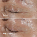 Buy now Clinique Smart Clinical Repair Wrinkle Correcting Eye Cream With Hyaluronic Acid + Peptides | Anti-Aging, Hydrating + Depuffing at indiglob india