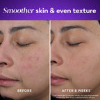 Buy now Olay Retinol Night Cream for Women, Anti-Aging Face Moisturizer, Fragrance-Free, Non Greasy - Anti-Wrinkle, Smooth Fine Lines, Hydrating Skin Care - Triple Collagen Cream, Peptide, Niacinamide, 1.7oz at indiglob india