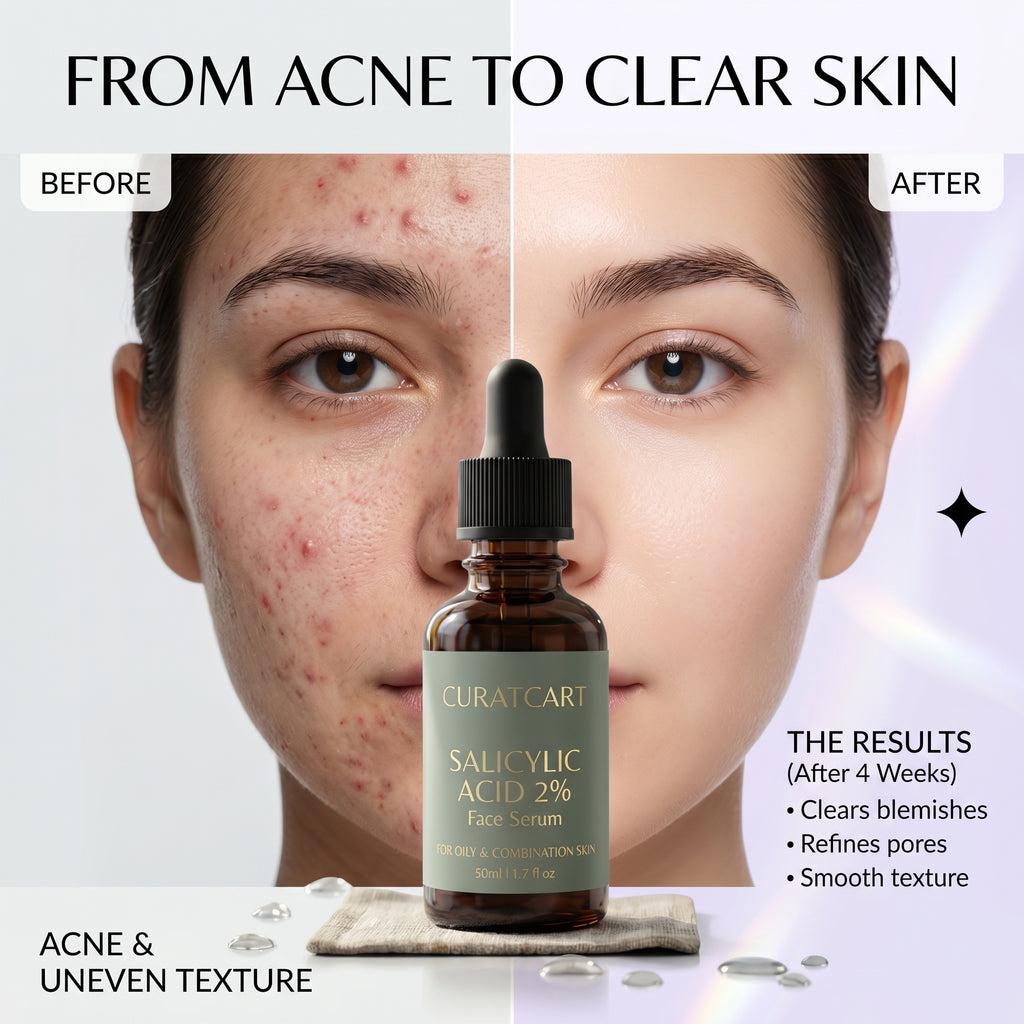 Before and after photos showing the blemish-control results of CURAT CART Face Serum on acne and uneven texture.
