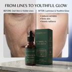 Before and after photos demonstrating fine line reduction and a youthful glow from CURAT CART Retinol Face Serum.