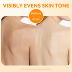 Experience premium imported Acidified Body Wash from Curat Cart for visibly even skin tone and enhanced radiance.
