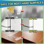 Effectively remove adhesive residues with the Adhesive Remover Spray Kit. Perfect for daily use on various surfaces. Available at Curat Cart.