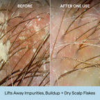 Before and after images showing scalp treatment effectiveness, removing impurities and flakes for healthier hair.