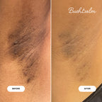 Transform your skin with Bushbalm 2-Step Ingrown Hair Routine. Premium treatment for smooth skin, tackles ingrown hairs effectively.