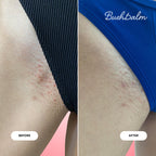 Before and after images showcasing the effectiveness of Bushbalm's 2-Step Ingrown Hair Routine for smoother skin.